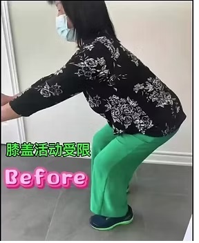 体态/膝关节改善案例